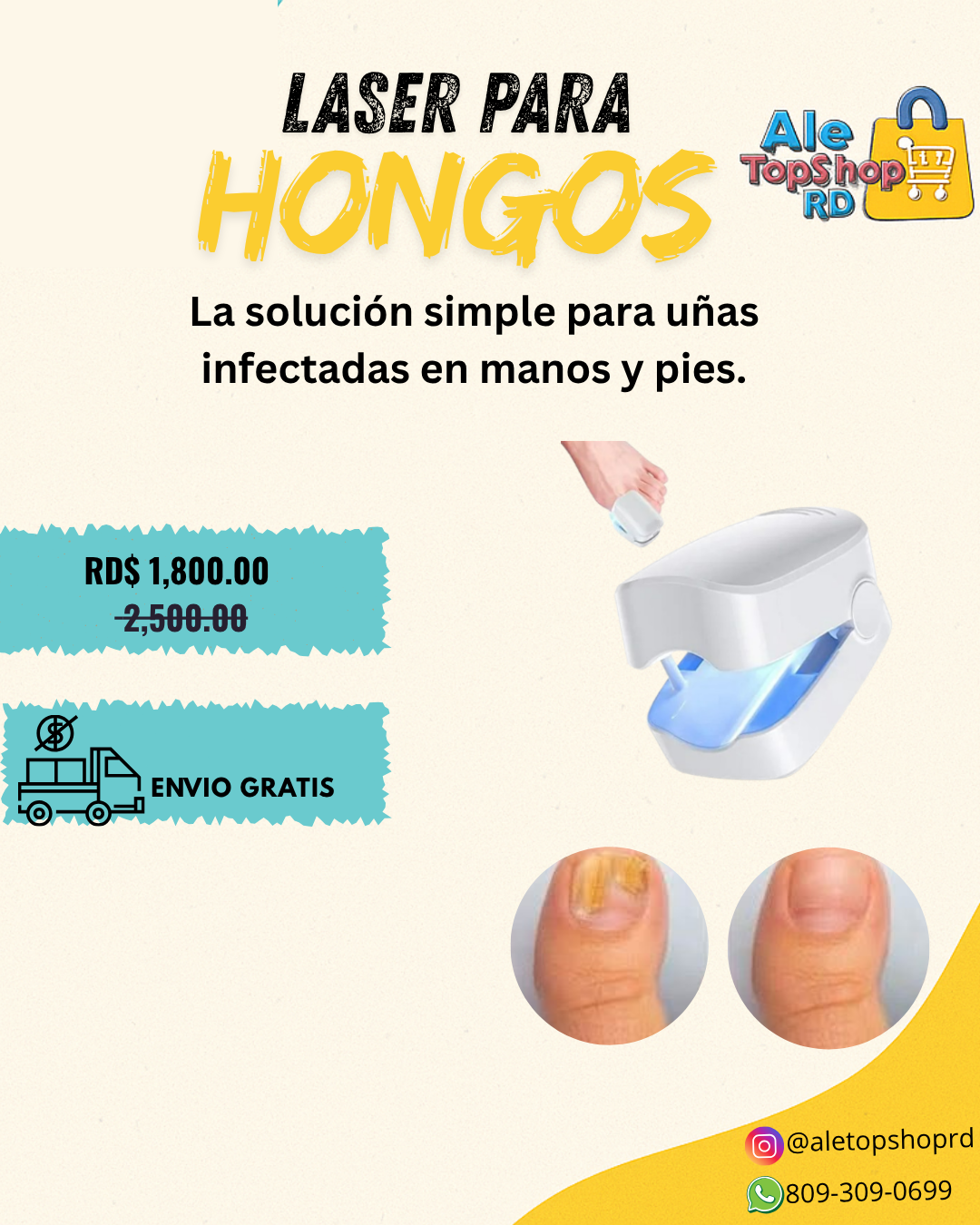 LASER PARA HONGOS