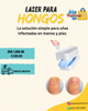 LASER PARA HONGOS